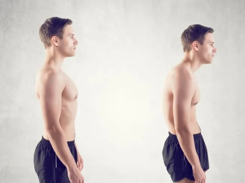 Tình trạng gù cột sống có thể xuất phát từ nhiều nguyên nhân