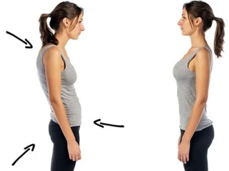 Nếu không điều trị, hội chứng cổ rùa có thể dẫn đến những biến chứng