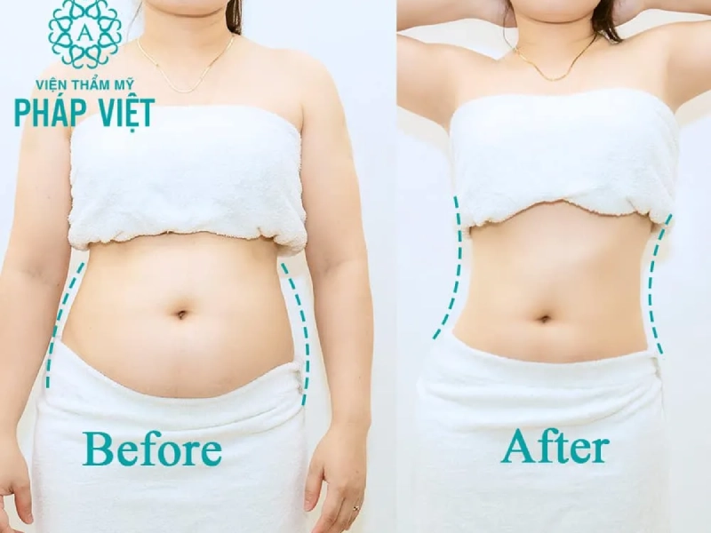 Viện Thẩm Mỹ Pháp Việt