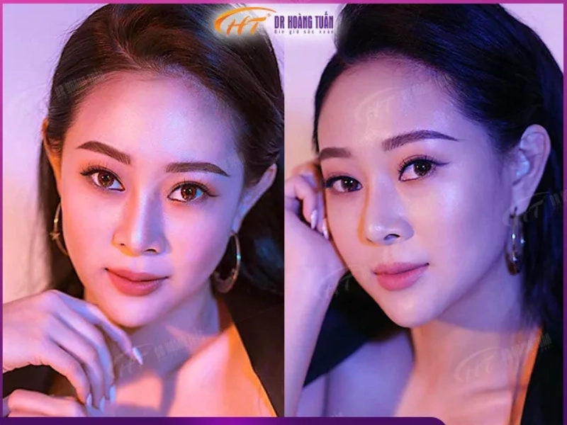 Thẩm Mỹ Hoàng Tuấn Hải Phòng