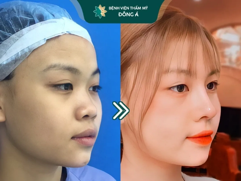 Thẩm Mỹ Viện Đông Á Hải Phòng