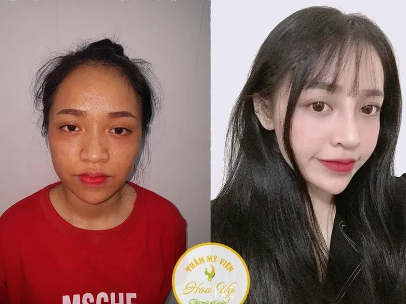 Thẩm Mỹ Viện HoaVy.