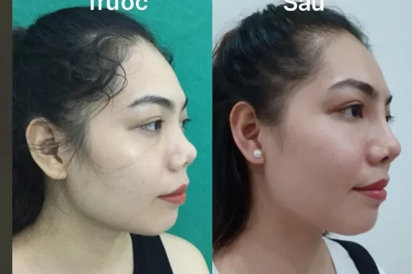 Thẩm mỹ bác sĩ Thành Thủy
