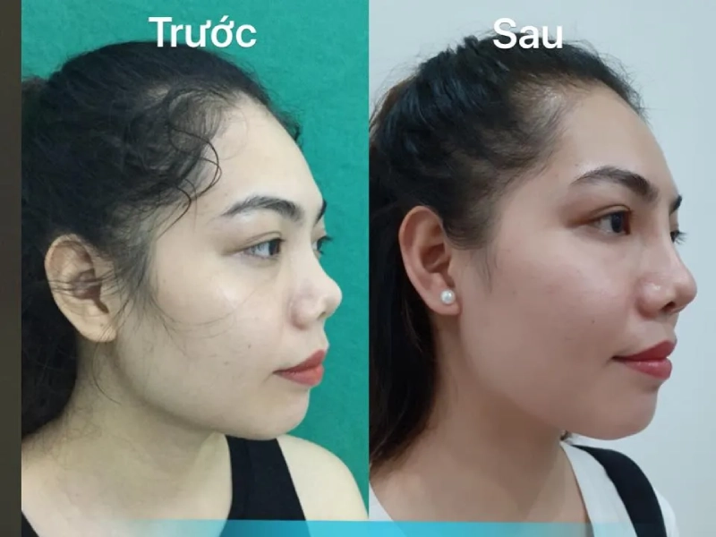 Thẩm mỹ bác sĩ Thành Thủy