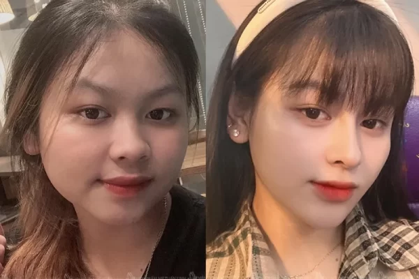 Viện Thẩm Mỹ Tuấn Linh
