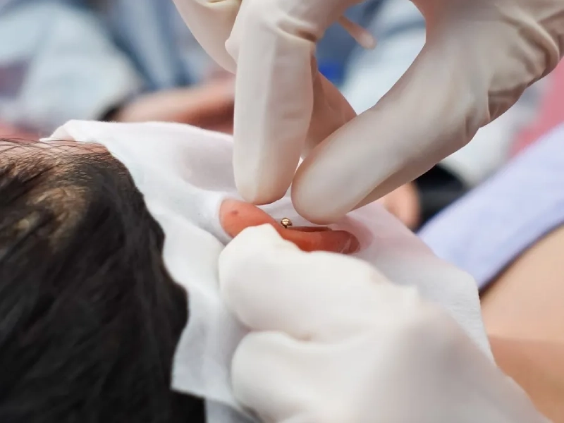 Trải nghiệm dịch vụ xỏ khuyên chất lượng tại Vịt Xỏ Khuyên