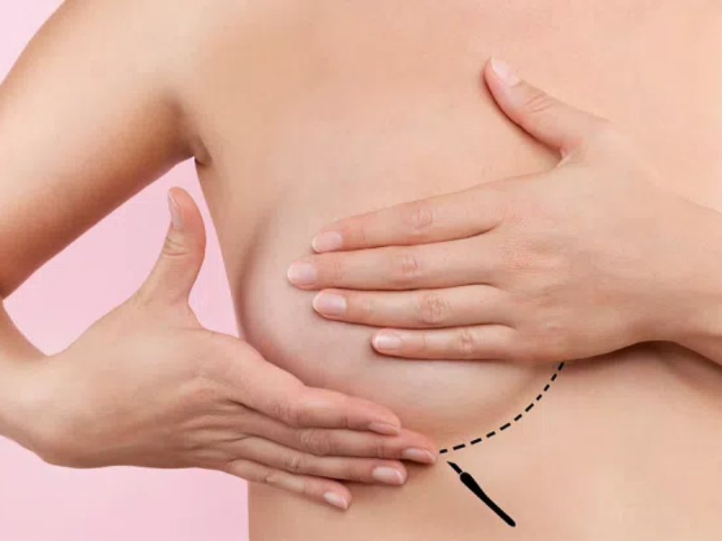 Massage giúp tăng kích thước vòng 1