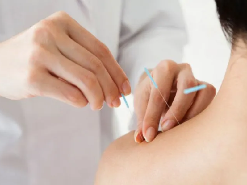 Các phương pháp điều trị đau cổ vai gáy