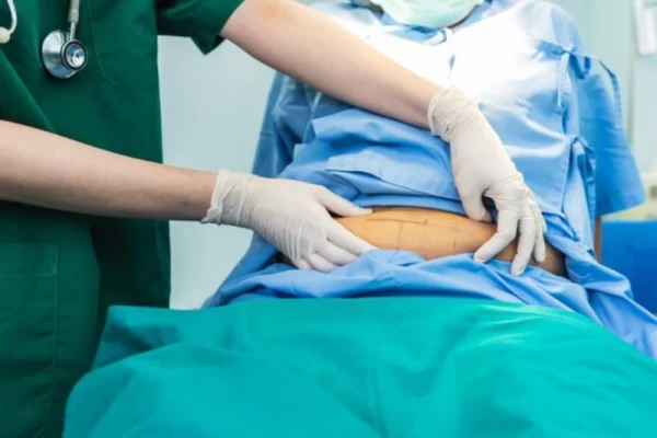 Gợi ý các cơ sở hút mỡ tại TPHCM được khách hàng tin tưởng