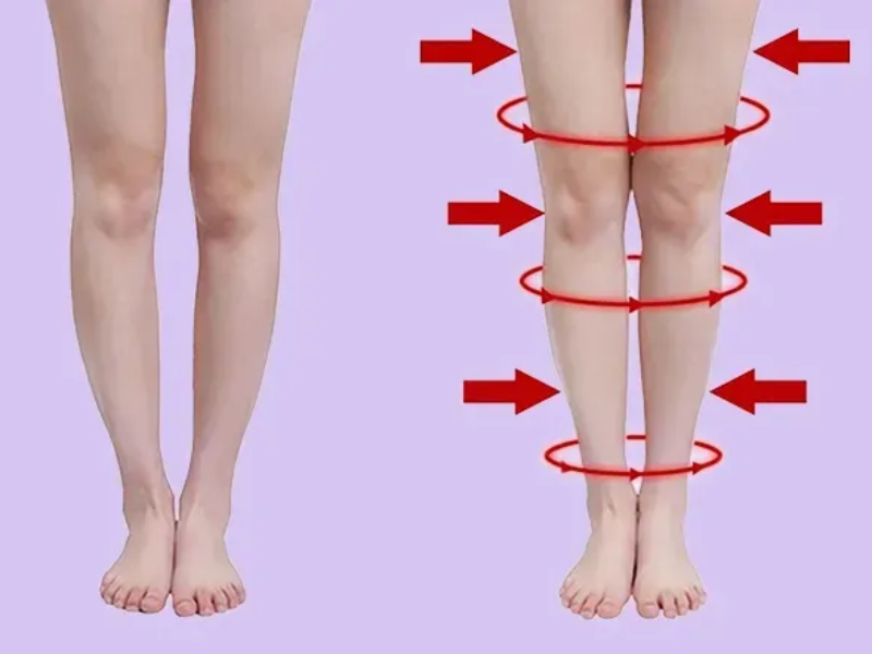 The image on the left shows bow legs.